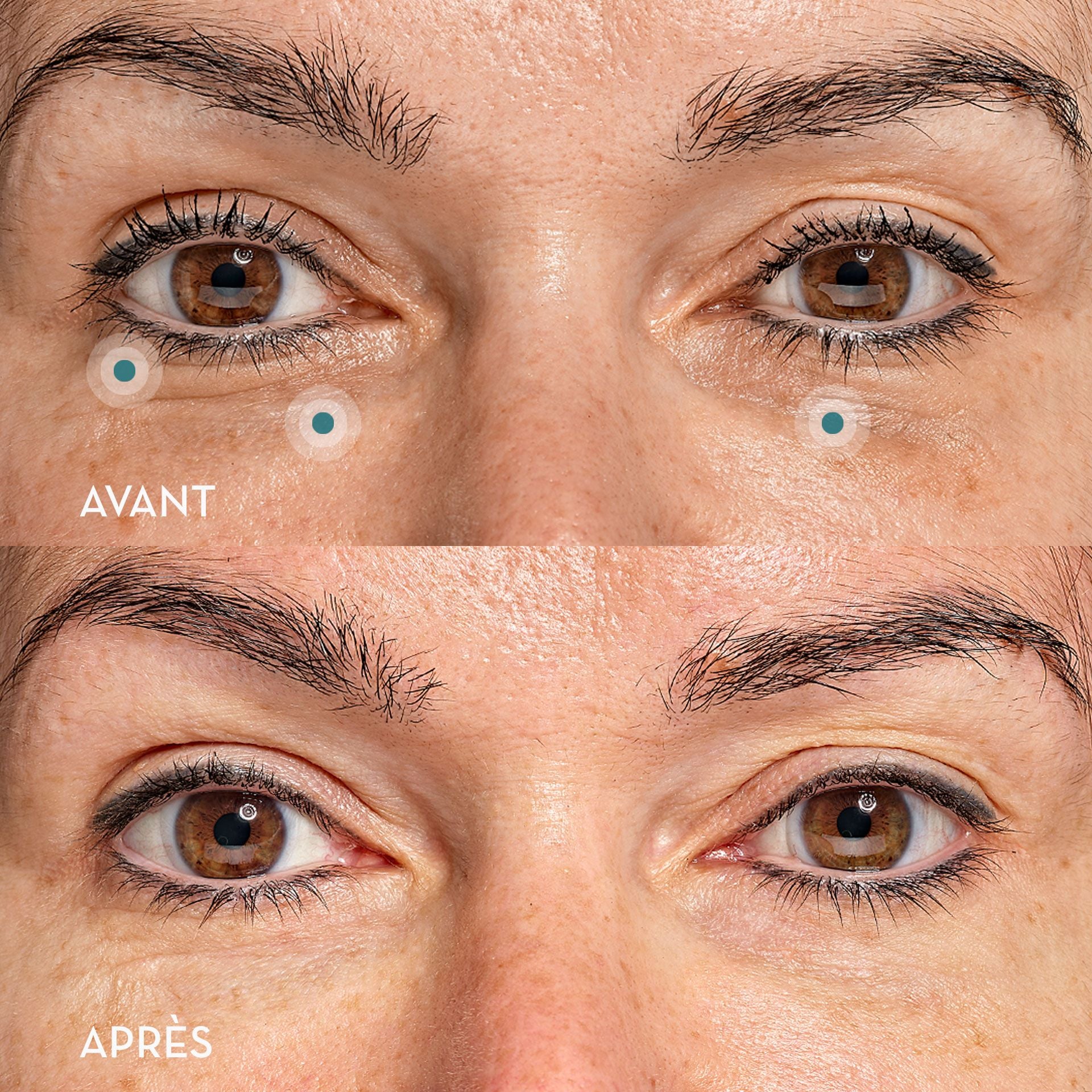 Eye Recipe - Complete Eye Contour - Skin Office Paris