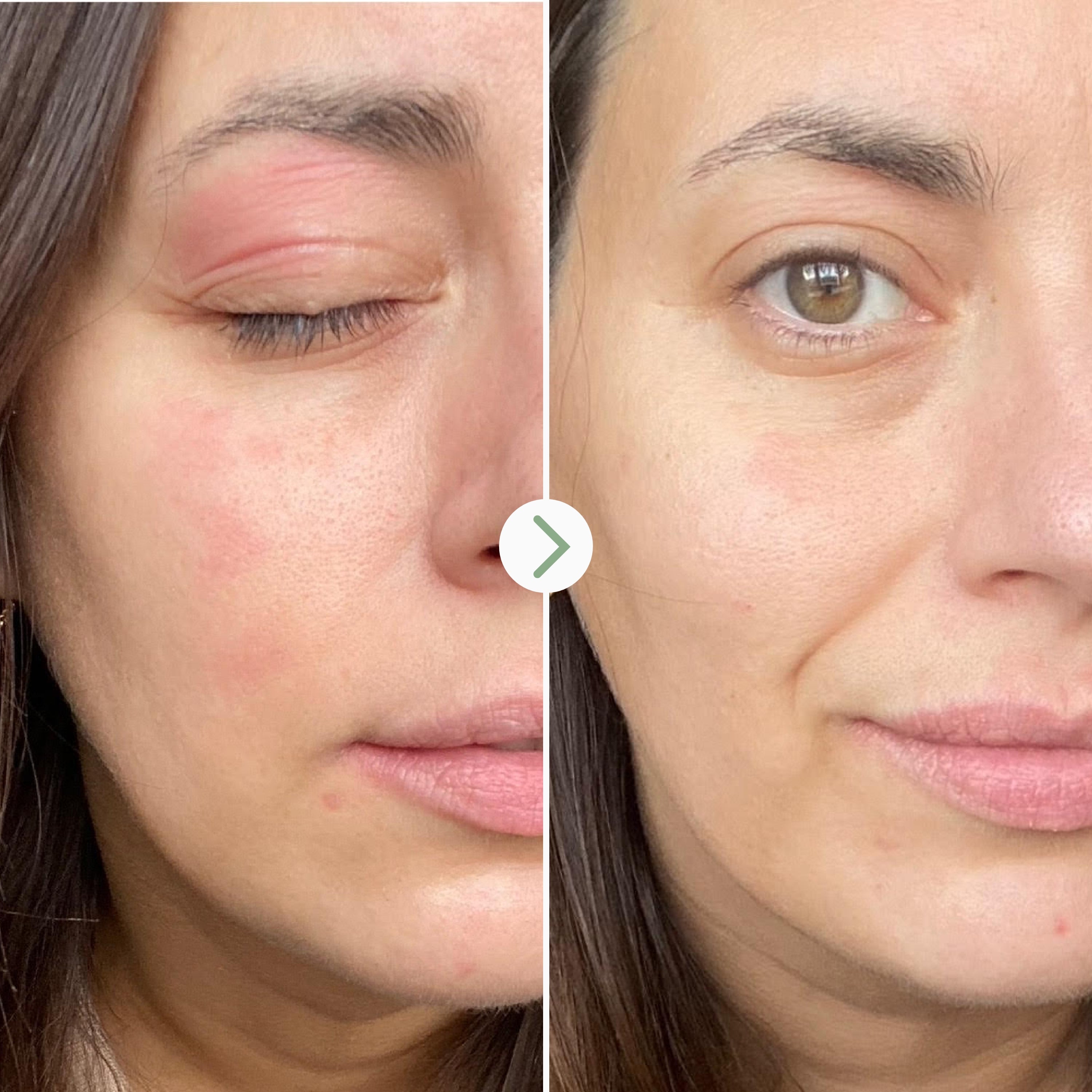 Comparativa antes y después con Feather Canyon, mirada visiblemente más hidratada, luminosa y suave.