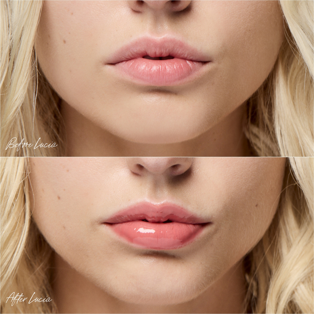 Hidratación visible y brillo jugoso que transforma los labios con un toque natural y luminoso.
